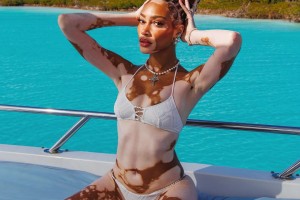 求婚成功后，库兹马与自己的白癜风超模未婚妻出海度假